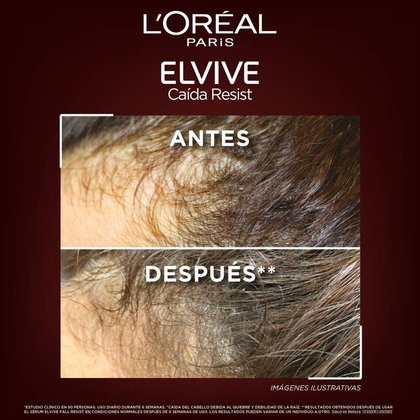 Resultados del acondicionador Aminexil Perú. Antes y Después: Cabello más denso y cuero cabelludo menos visible